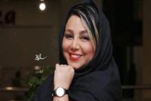 تغییرات باورنکردنی چهره بهنوش بختیاری/فیلم