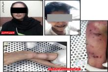 قتل هولناک پسربچه هفت ساله در شکنجه‌گاه نامادری