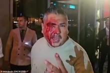 درگیری خونین محافظان مسی با خانواده آمریکایی