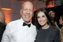 بازنشستگی بازیگر مشهور به علت بیماری عجیب