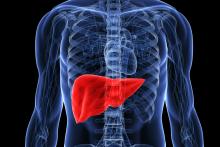 درمان کبد چرب با یک تغییر در رژیم غذایی