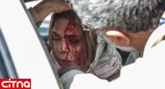 انتشار اولین عکس از گوهر خیراندیش پس از تصادف