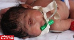 انتشار گسترده تصویر "نوزاد شبیه به دجال" در فضای مجازی جهان عرب +عکس