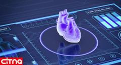 پیش‌بینی حمله قلبی با بررسی عکس رادیولوژی توسط هوش مصنوعی