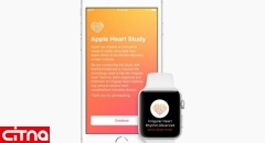 تشخیص ضربان غیرطبیعی قلب توسط ساعت هوشمند اپل