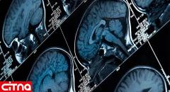 رمزگشایی سیگنال‌های مغزی برای احساس درد توسط محققان برای اولین بار