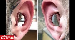 جراحی عجیب گوش برای افزایش فالوور
