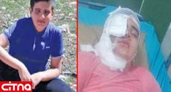 عکس قبل و بعد اسیدپاشی به پسر دانش آموز 11 ساله کرمانشاهی