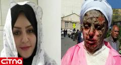 عکس تکاندهنده زن تبریزی قبل و بعد اسیدپاشی (+وضعیت پرونده)