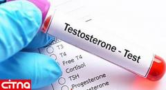 تستوسترون پایین در مردان با چه علائمی نمود پیدا می‌کند؟