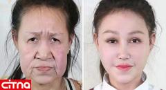 جراحی زیبایی یک پیرزن را به دختری 15 ساله تبدیل کرد (+عکس)