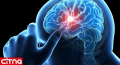 نشانه‌های هشداردهنده در سکته مغزی