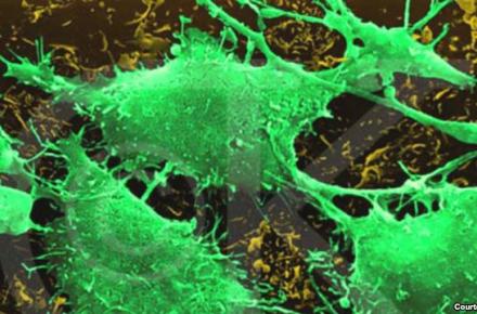 نرم افزار پزشکی پیش بینی سرطان 