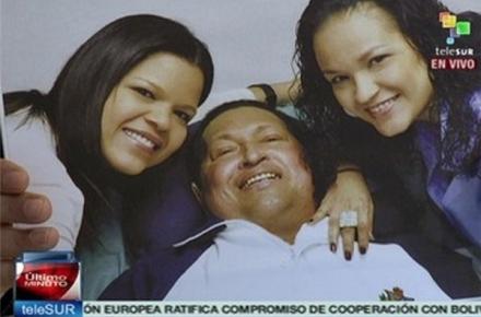 اولین تصویر «چاوز» پس از عمل جراحی به اینترنت راه یافت