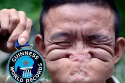 دعوت روزنامه‎ی کویتى "الانباء" از زشت‎ترین انسان‎های دنیا برای رقابت!