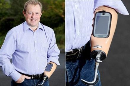 اولین دست مصنوعی که تلفن همراه شد! 