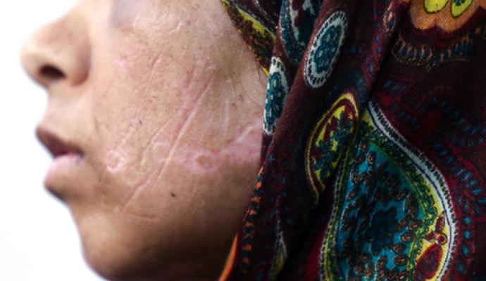 روایت شکنجه یک زن و دخترانش توسط هیولایی انسان نما (+تصاویر)