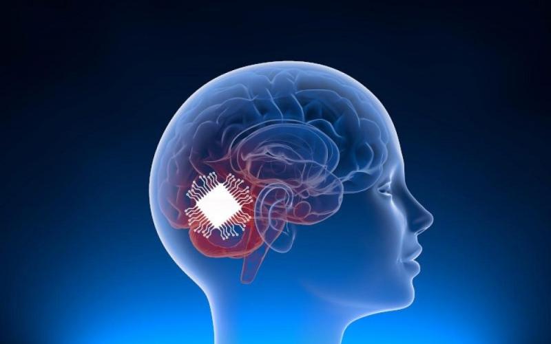 ایمپلنت مغزی