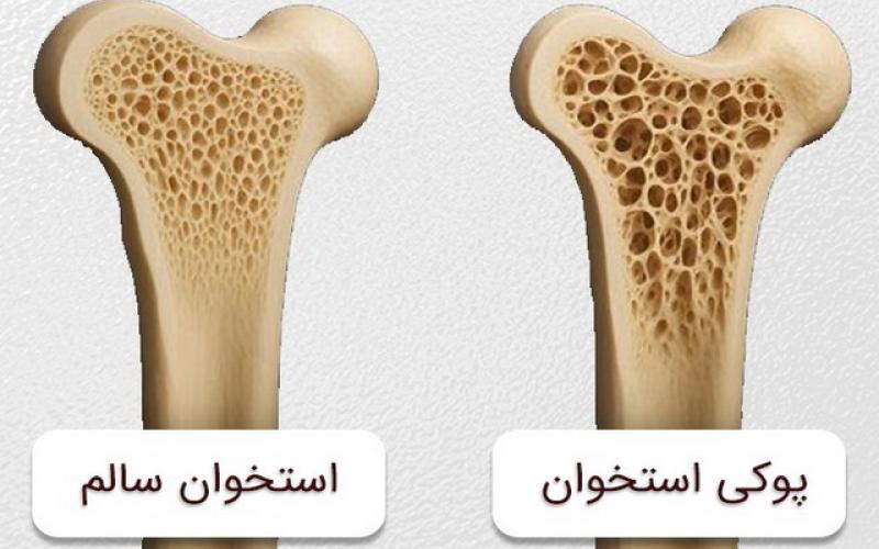 پوکی