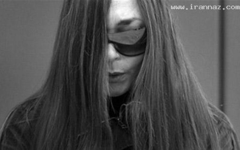 فروش اعضای بدن این زن فقیر در اینترنت +عکس