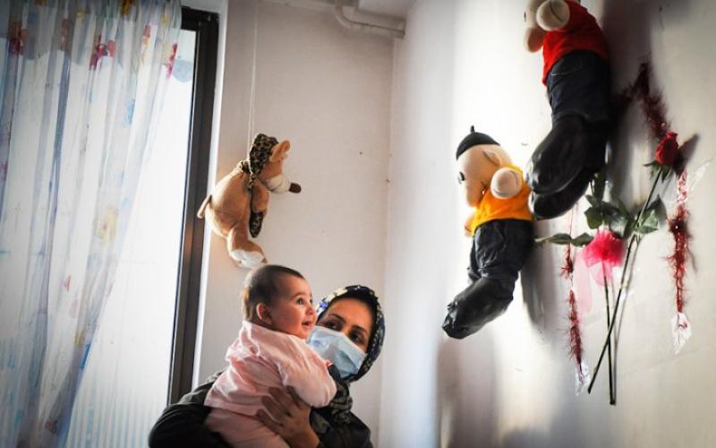 کودک چهار ماهه‎ی گیلانی هم اکنون نیازمند کمک شما هموطنان عزیز است