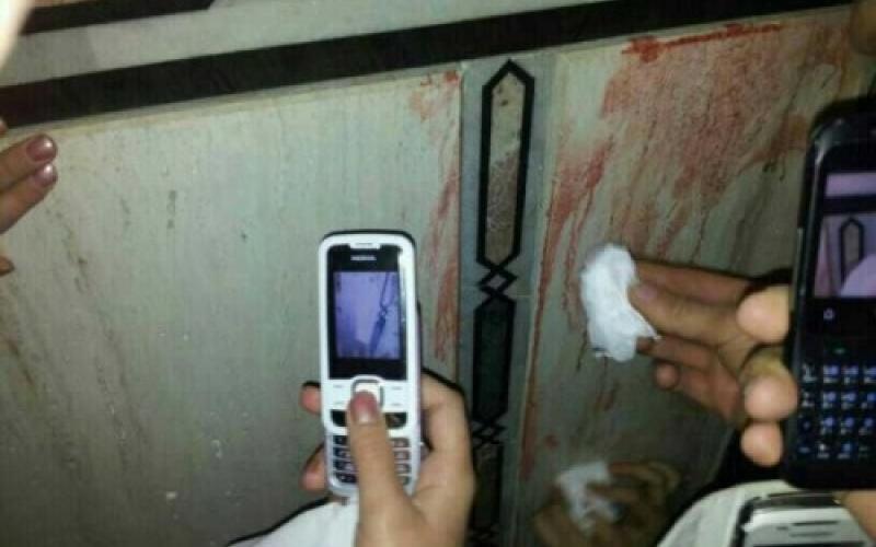 ضریح و دیوار مرقد شریف دختر سیدالشهداء خون گریست +تصاویر 