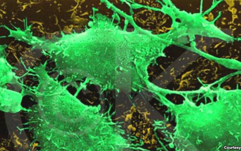 نرم افزار پزشکی پیش بینی سرطان 