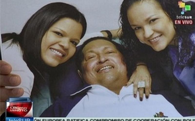 اولین تصویر «چاوز» پس از عمل جراحی به اینترنت راه یافت