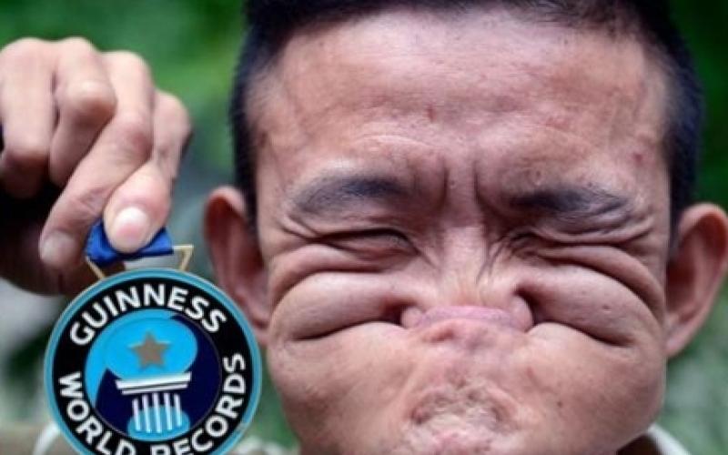 دعوت روزنامه‎ی کویتى "الانباء" از زشت‎ترین انسان‎های دنیا برای رقابت!