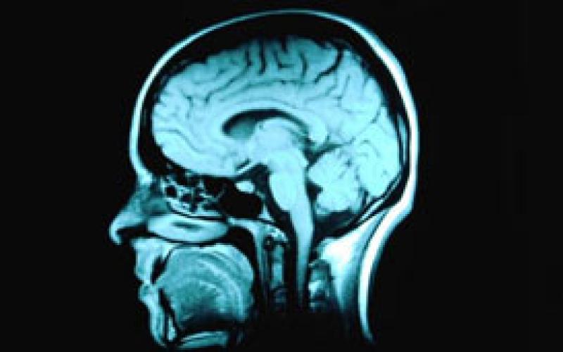 اختلالات در بافت سفید مغز معتادان به اینترنت 