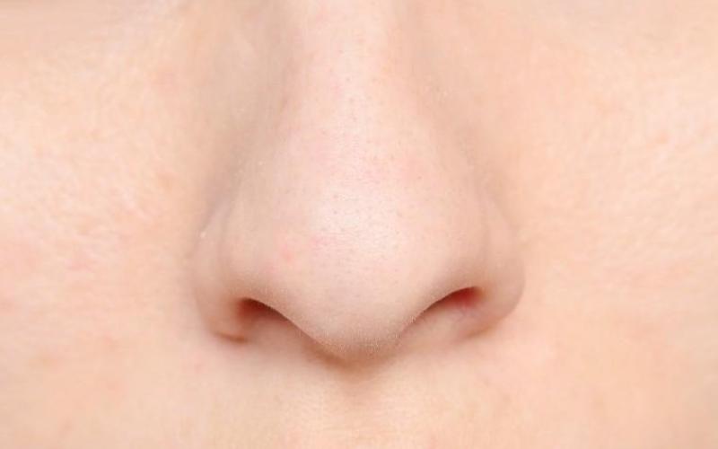 چالش فیسبوکی «دماغ طبیعی من»