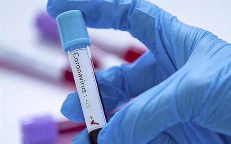 تشخیص کرونا با کیت‌های ایرانی ممکن شد