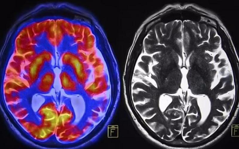 هوش مصنوعی پاسخ می‌دهد: آیا مغز زنان و مردان متفاوت است؟