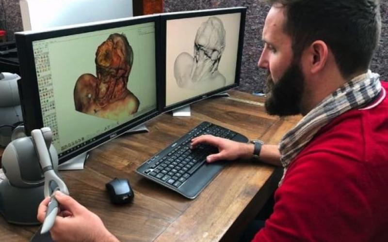 امکان آموزش عمل جراحی با واقعیت مجازی