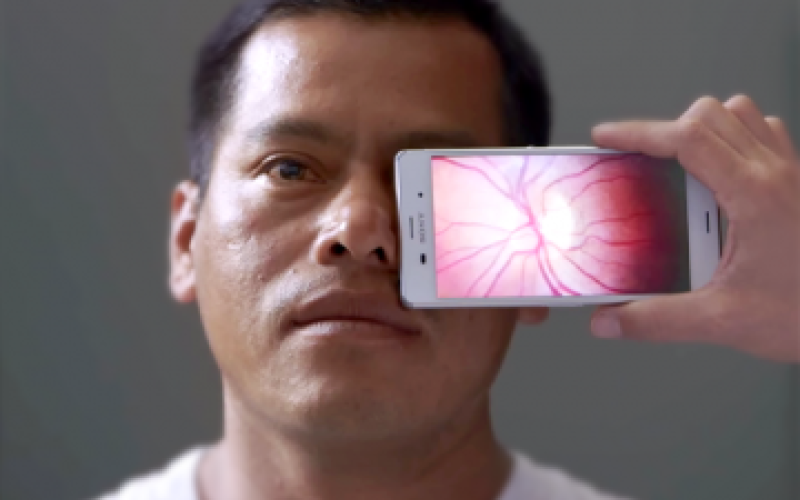 آزمایش چشم با موبایل!