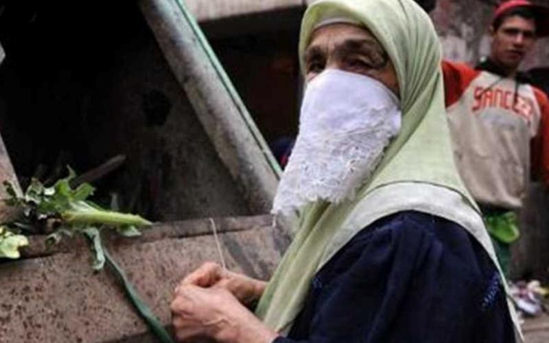 جنین سنگی 35 ساله در شکم پیرزن 73 ساله! (+عکس)