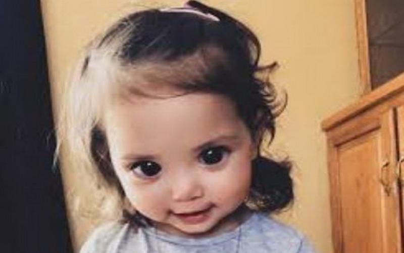 سندرمی نادر دختر خردسال را صاحب چشمانی فوق العاده زیبا کرد