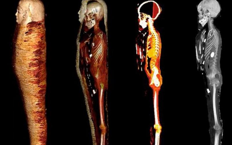 اسکن دیجیتالی از مومیایی 2300 ساله رازهایی شگفت‌انگیزی را آشکار کرد