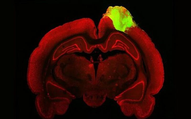 ثبت دقیق‌ترین تصویر سلول‌های مغز با یک میکروسکوپ مینیاتوری