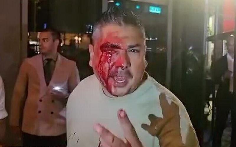 درگیری خونین محافظان مسی با خانواده آمریکایی