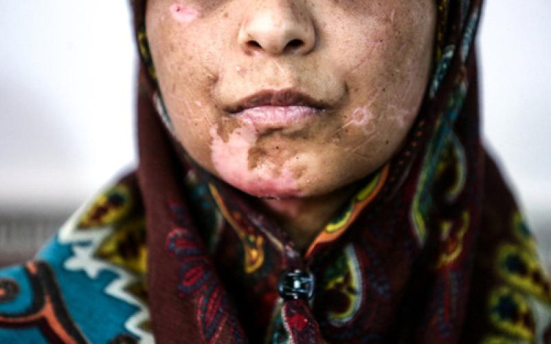 روایت شکنجه یک زن و دخترانش توسط هیولایی انسان نما (+تصاویر)