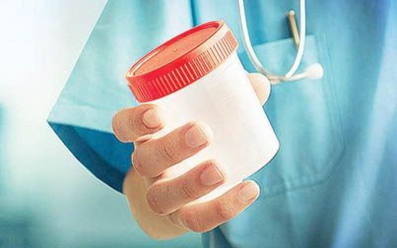 درآمد چند 100 میلیونی ستاره فوتبال ایران با فروش اسپرم!