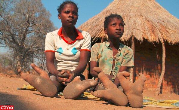 پاهای شترمرغی عجیب قبیله‌ای در آفریقا(+عکس)